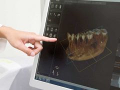 モニターを使って歯の状態を説明している男性歯科医師