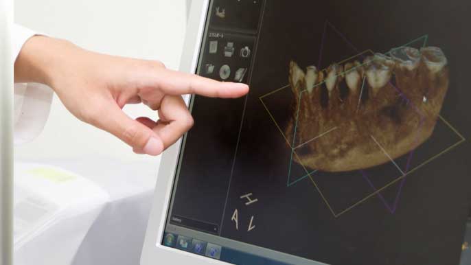 モニターを使って歯の状態を説明している男性歯科医師